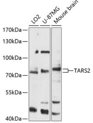 Western Blot: TARS2 AntibodyAzide and BSA Free [NBP2-93450]