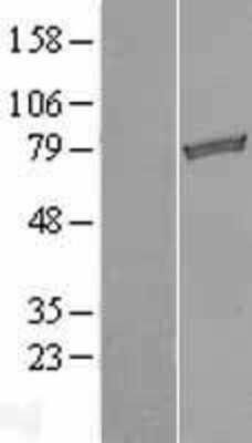 Western Blot: TARS2 Overexpression Lysate [NBL1-16704]