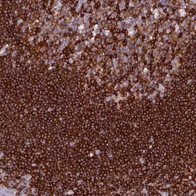 Immunohistochemistry-Paraffin: TARSH Antibody [NBP2-48811]