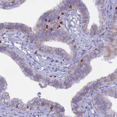 Immunohistochemistry-Paraffin: TARSH Antibody [NBP2-48811]