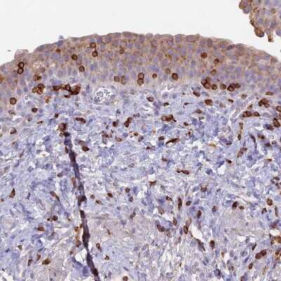 Immunohistochemistry-Paraffin: TARSH Antibody [NBP2-48811]