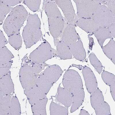 Immunohistochemistry-Paraffin: TARSH Antibody [NBP2-48811]