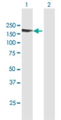 Western Blot: TARSH Antibody [H00025890-B01P]