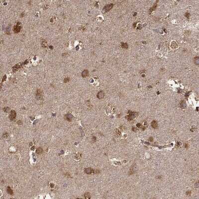 Immunohistochemistry-Paraffin: TARSL2 Antibody [NBP2-56375]
