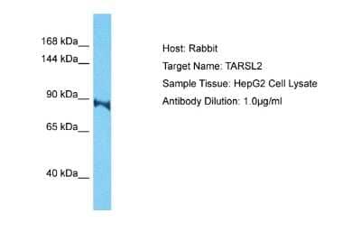 Western Blot: TARSL2 Antibody [NBP2-83616]