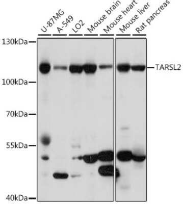 Western Blot: TARSL2 AntibodyAzide and BSA Free [NBP2-94438]