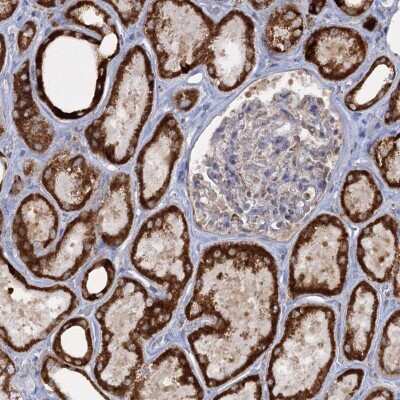 Immunohistochemistry-Paraffin: TAS1R1 Antibody [NBP2-48624]