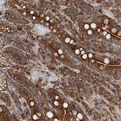 Immunohistochemistry-Paraffin: TAS1R1 Antibody [NBP1-83338]