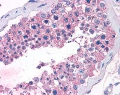 Immunohistochemistry-Paraffin: TAS1R1 Antibody - BSA Free [NLS1992]
