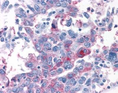 Immunohistochemistry-Paraffin: TAS1R1 Antibody - BSA Free [NLS1992]