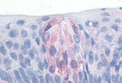 Immunohistochemistry-Paraffin: TAS1R1 Antibody - BSA Free [NLS1992]