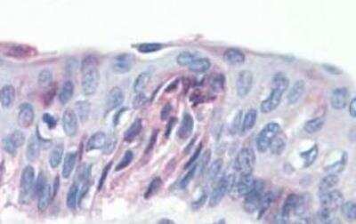 Immunohistochemistry-Paraffin: TAS1R1 Antibody - BSA Free [NLS1992]