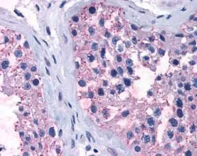 Immunohistochemistry-Paraffin: TAS1R1 Antibody - BSA Free [NLS1994]