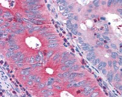Immunohistochemistry-Paraffin: TAS1R1 Antibody - BSA Free [NLS1994]