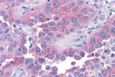 Immunohistochemistry-Paraffin: TAS1R1 Antibody - BSA Free [NLS1994]