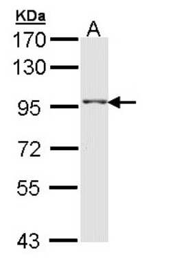 Western Blot: TAS1R1 Antibody [NBP2-20570]