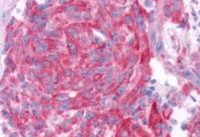 Immunohistochemistry-Paraffin: TAS1R2 Antibody - BSA Free [NLS2007]