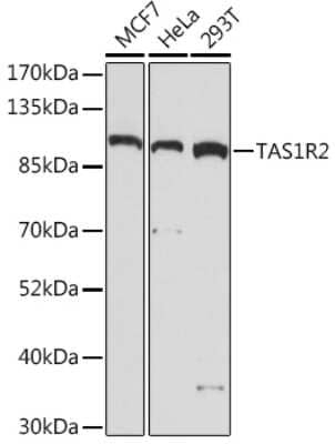 Western Blot: TAS1R2 AntibodyAzide and BSA Free [NBP3-15535]