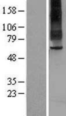 Western Blot: TAS1R2 Overexpression Lysate [NBL1-16706]