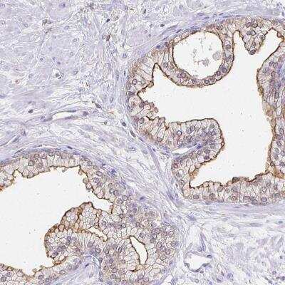 Immunohistochemistry-Paraffin: TAS1R3 Antibody [NBP2-33683]