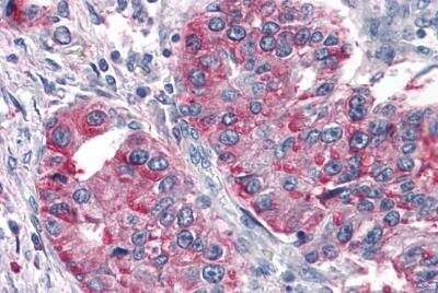 Immunohistochemistry-Paraffin: TAS1R3 Antibody - BSA Free [NLS5060]