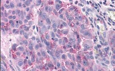 Immunohistochemistry-Paraffin: TAS1R3 Antibody - BSA Free [NLS5060]