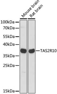 Western Blot: TAS2R10 AntibodyAzide and BSA Free [NBP2-94569]