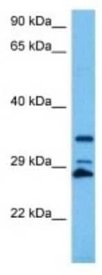 Western Blot: TAS2R103 Antibody [NBP3-10232]