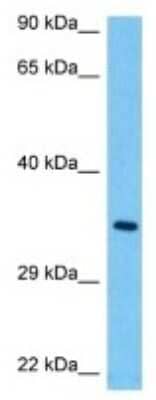 Western Blot: TAS2R106 Antibody [NBP3-10242]