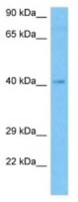 Western Blot: TAS2R123 Antibody [NBP3-10228]