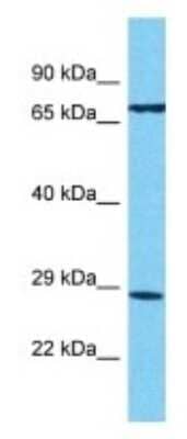 Western Blot: TAS2R13 Antibody [NBP3-09892]