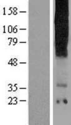 Western Blot: TAS2R16 Overexpression Lysate [NBP2-06987]