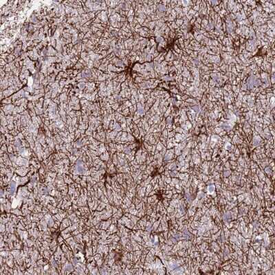 Immunohistochemistry: TAS2R38 Antibody [NBP2-33404]