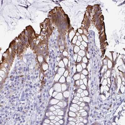 Immunohistochemistry-Paraffin: TAS2R38 Antibody [NBP2-33711]