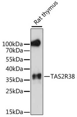 Western Blot: TAS2R38 AntibodyAzide and BSA Free [NBP2-95168]