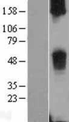 Western Blot: TAS2R38 Overexpression Lysate [NBL1-16708]