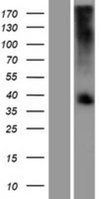 Western Blot: TAS2R39 Overexpression Lysate [NBP2-05026]