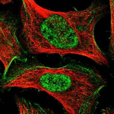 Immunocytochemistry/ Immunofluorescence: TAS2R42 Antibody [NBP1-83154]