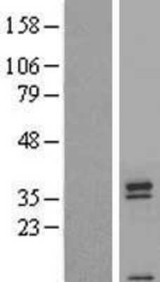 Western Blot: TAS2R42 Overexpression Lysate [NBP2-04921]