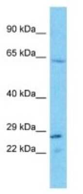 Western Blot: TAS2R43 Antibody [NBP3-09666]