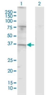 Western Blot: TAS2R49 Antibody [H00259295-D01P]