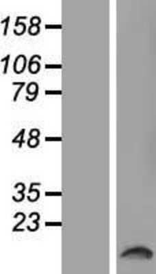 Western Blot: TAS2R50 Overexpression Lysate [NBP2-05027]