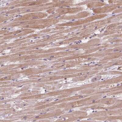 Immunohistochemistry: TASK-5/KCNK15 Antibody [NBP2-39038]