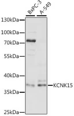 Western Blot: TASK-5/KCNK15 AntibodyAzide and BSA Free [NBP2-93885]