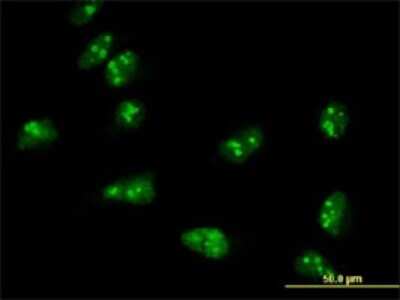 Immunocytochemistry/ Immunofluorescence: TASP1 Antibody (3E10) [H00055617-M01]