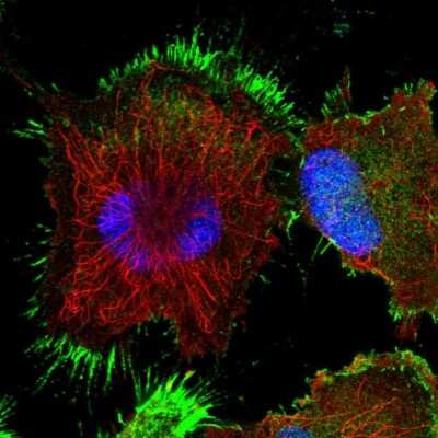 Immunocytochemistry/ Immunofluorescence: TASP1 Antibody [NBP1-88307]