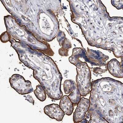 Immunohistochemistry-Paraffin: TASP1 Antibody [NBP1-88307]