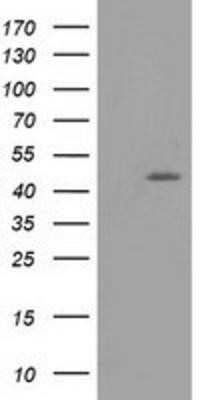 Western Blot: TASP1 Antibody (OTI1H6)Azide and BSA Free [NBP2-74444]