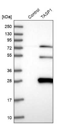 Western Blot: TASP1 Antibody [NBP1-88306]