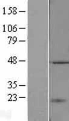 Western Blot: TASP1 Overexpression Lysate [NBL1-16714]